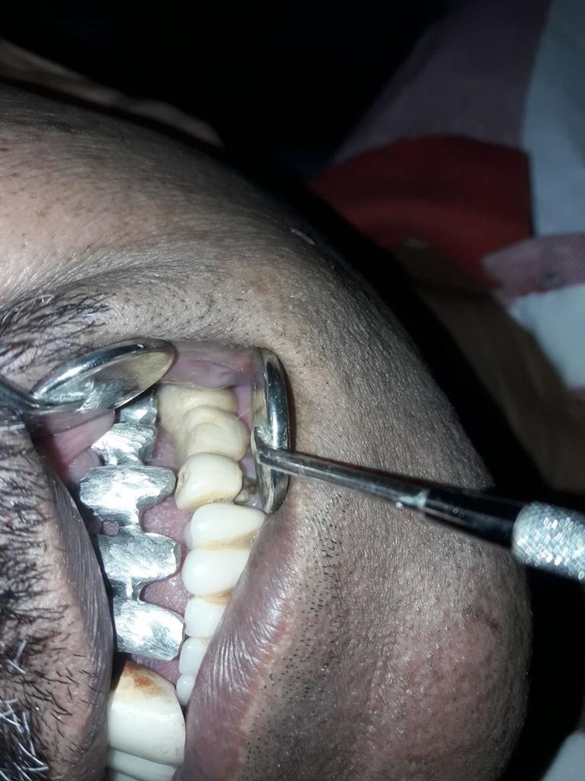 Implant image
