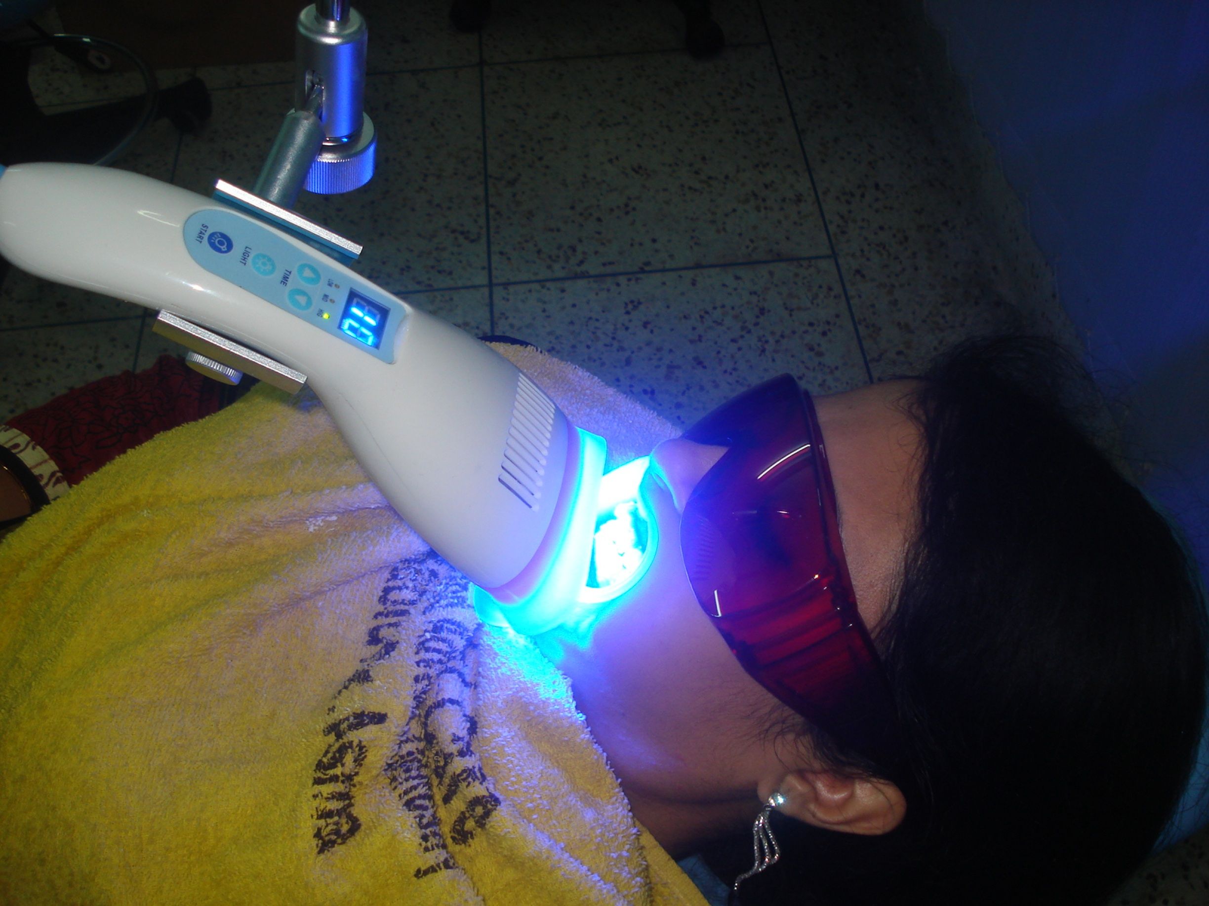 teeth whitening