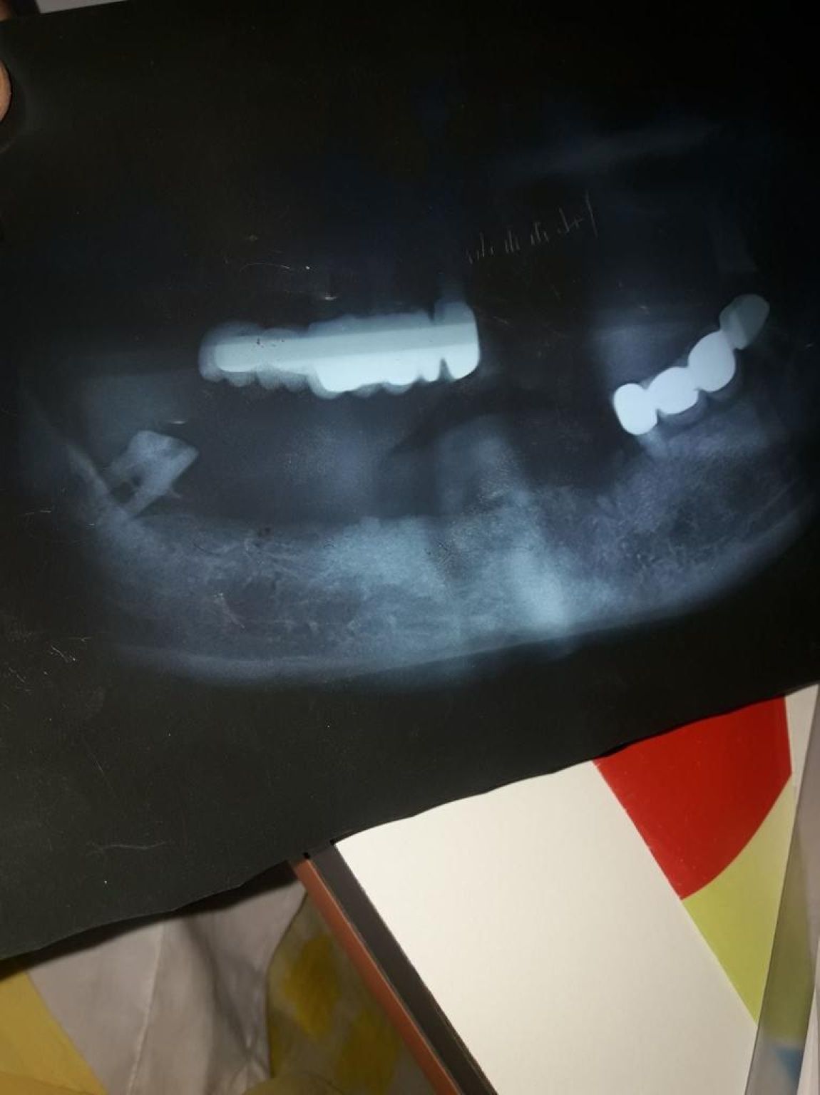Implant image