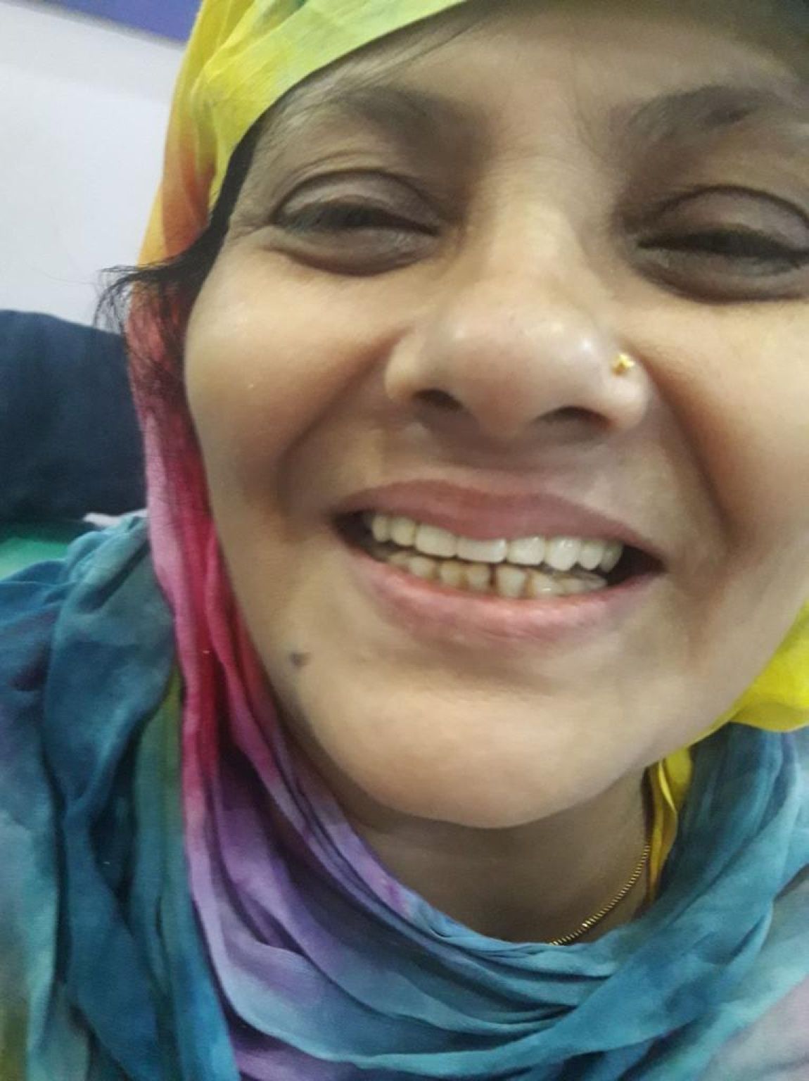 Implant image