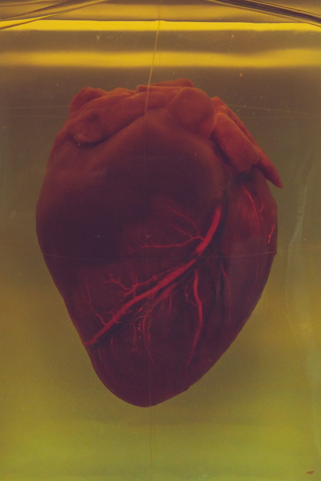 The image shows a preserved human heart displayed in a transparent container filled with liquid. The heart is depicted in detail, showcasing its structure and color, with visual emphasis on the blood vessels. — Credit: Photo by camilo jimenez on Unsplash