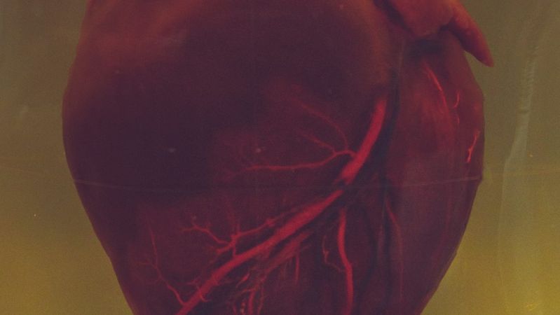 The image shows a preserved human heart displayed in a transparent container filled with liquid. The heart is depicted in detail, showcasing its structure and color, with visual emphasis on the blood vessels.