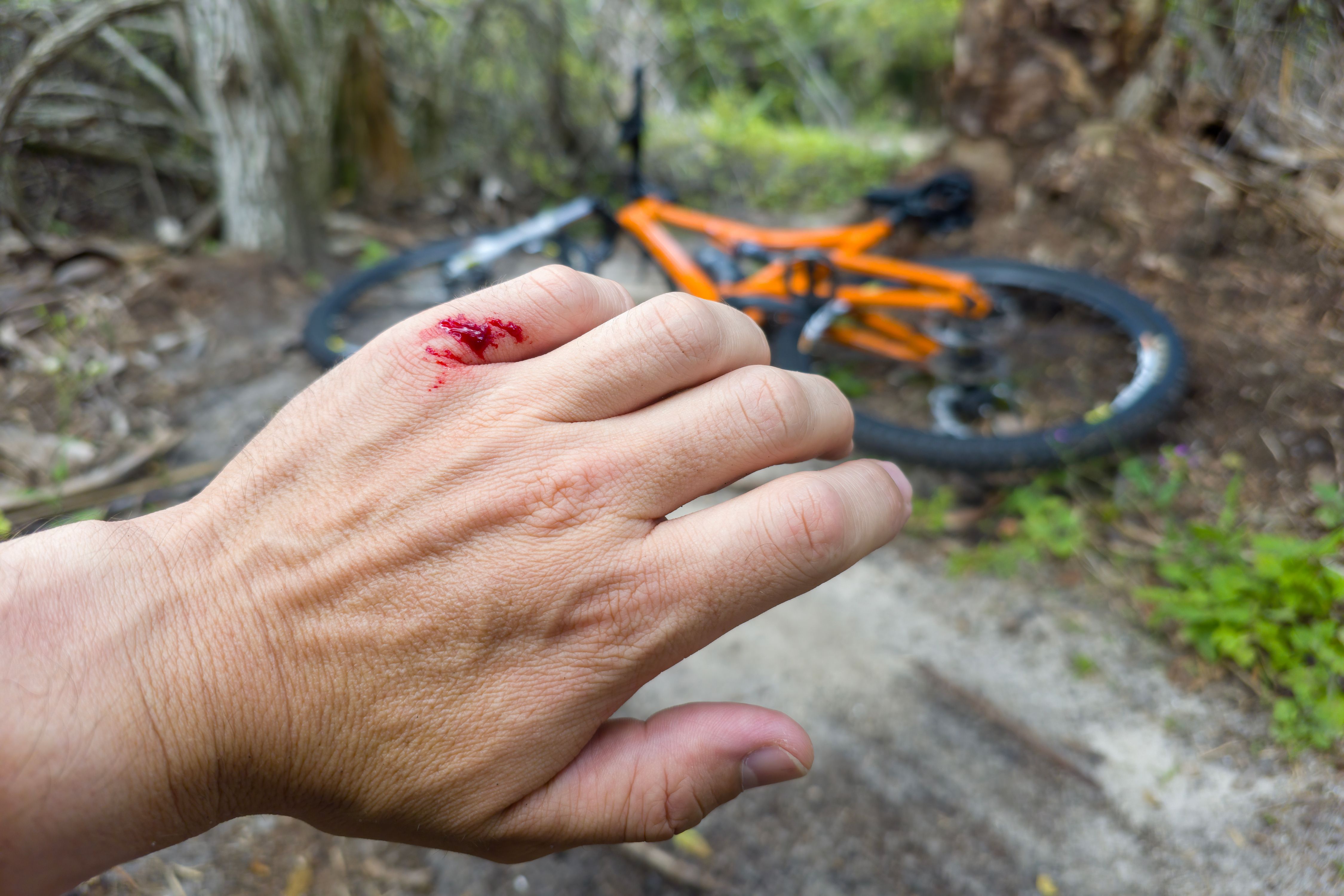 Cyclist Accidents: Ensuring Safety and Justice for Injured Riders