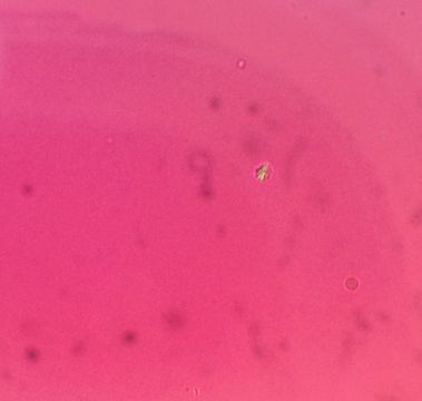 Joint Aspiration — mrcspartbquestions.com
