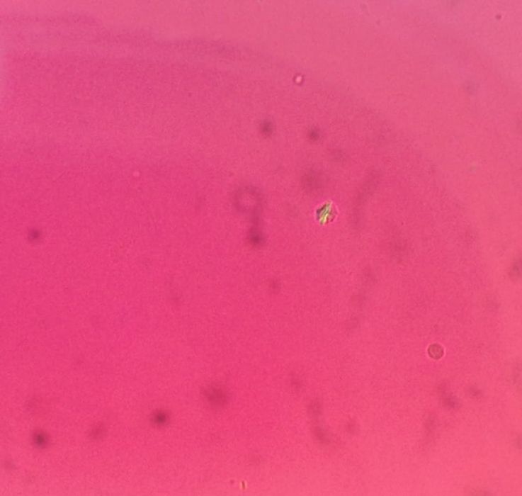 Joint Aspiration — mrcspartbquestions.com