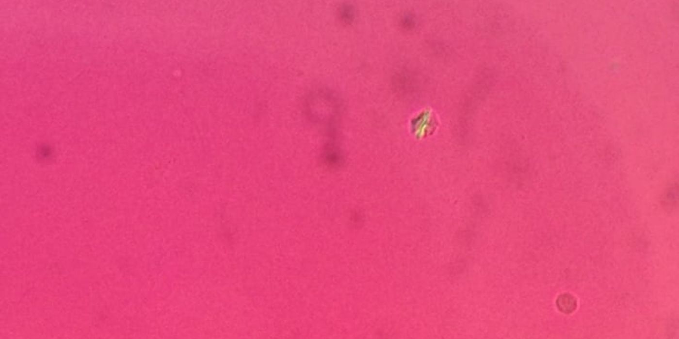 Joint Aspiration — mrcspartbquestions.com