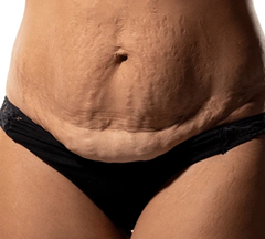 Loose and sagging Skin