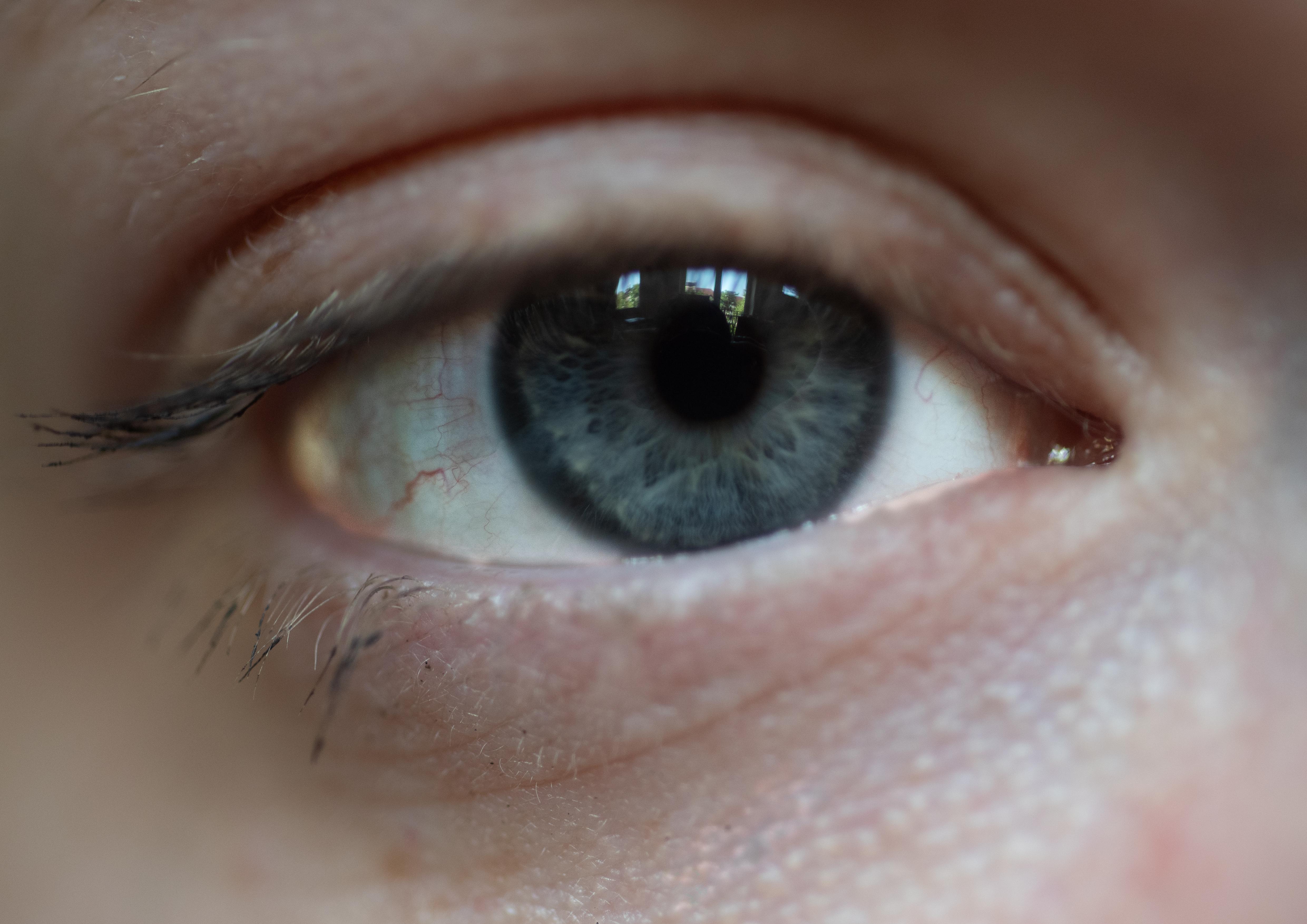 eye