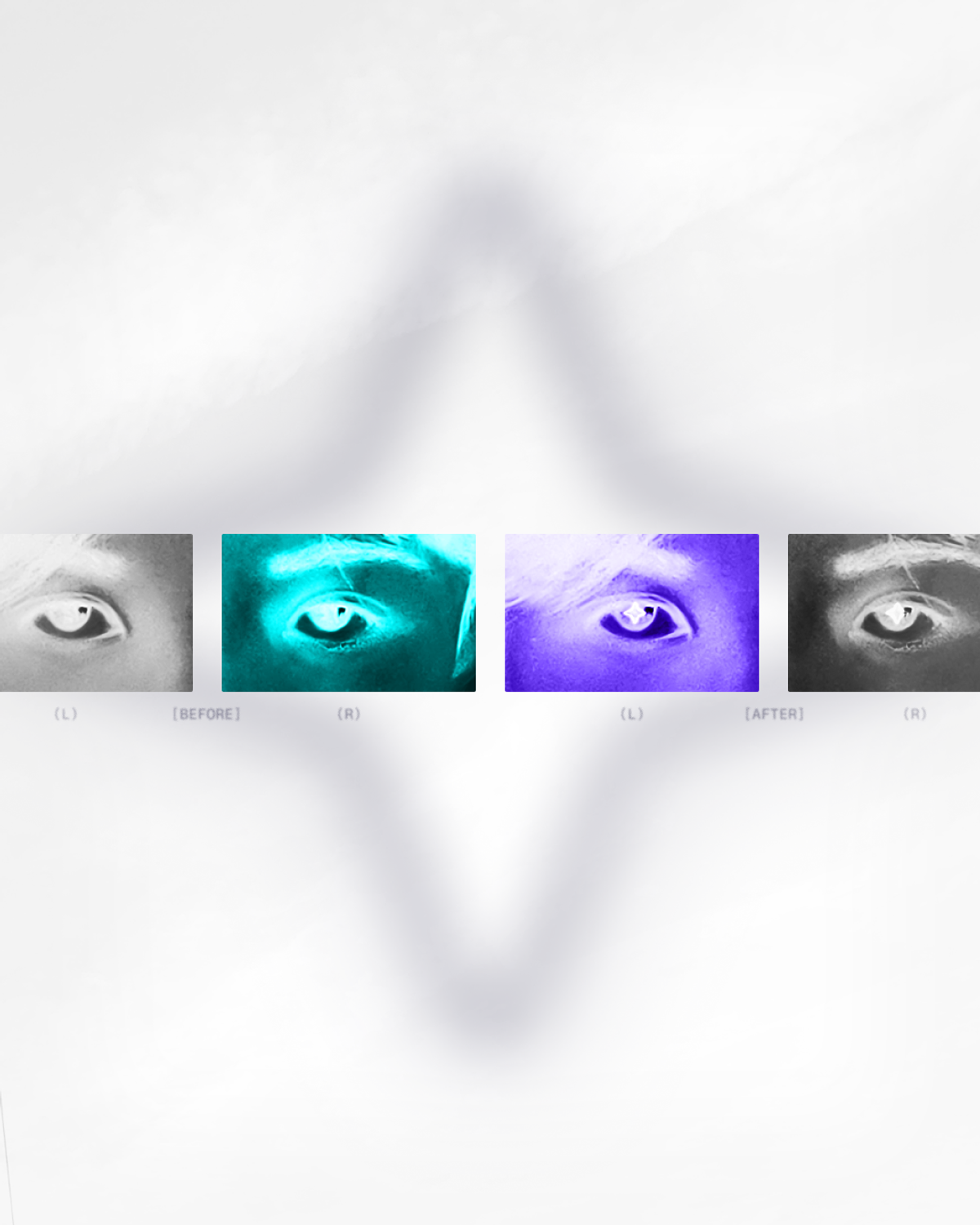 AERIUM WORLD · EYES CLOSE-UP X-RAY