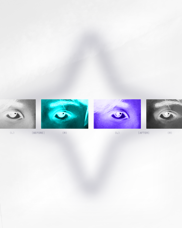 AERIUM WORLD · EYES CLOSE-UP X-RAY