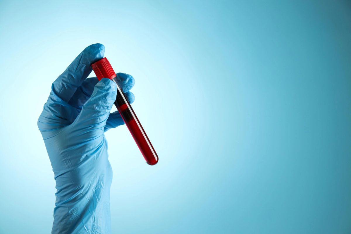 Alzheimer’s blood tests are for symptomatic patients, not screening
