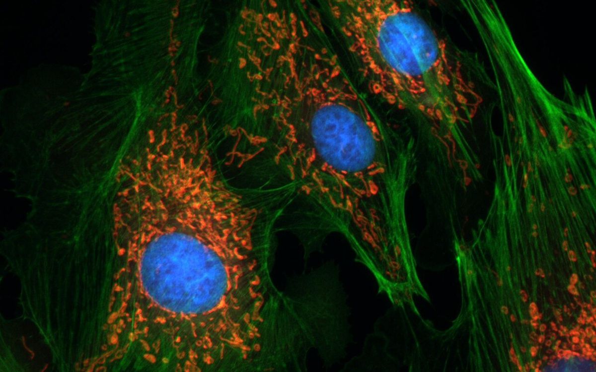 Fluorescence image of cells, nuclei in blue