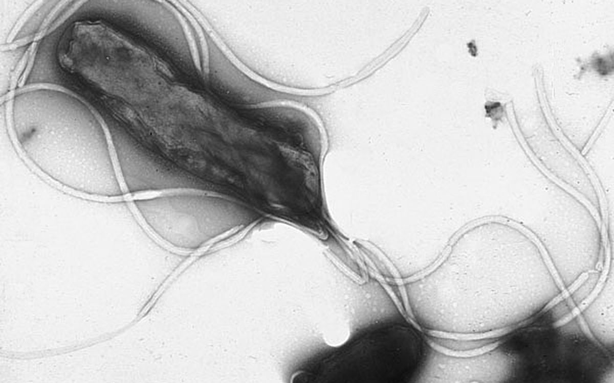 Electron micrograph of Helicobacter pylori
