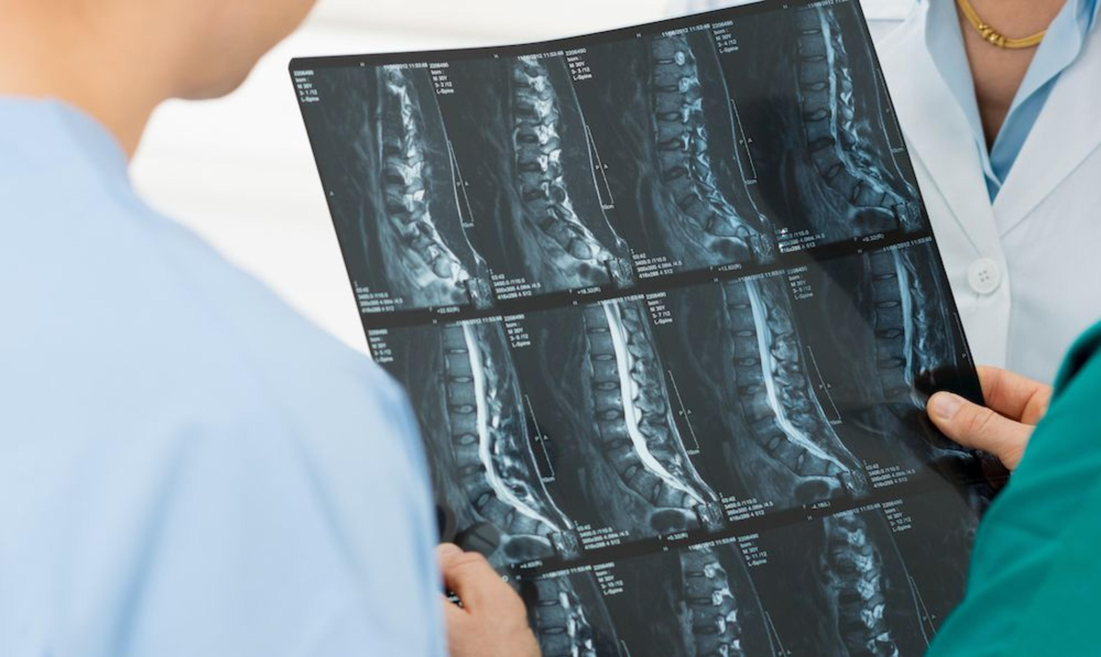 Spinal x-ray diagnostic imaging at CornerStone Chiropractic in Minot, ND