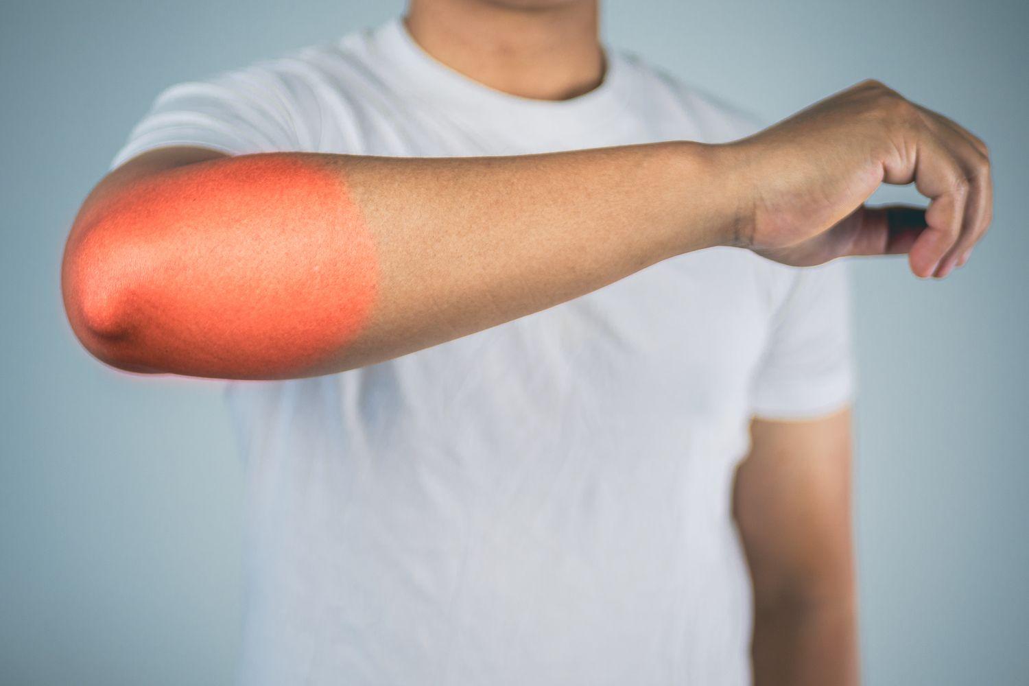Tennis elbow and golfer elbow care in Minot, North Dakota