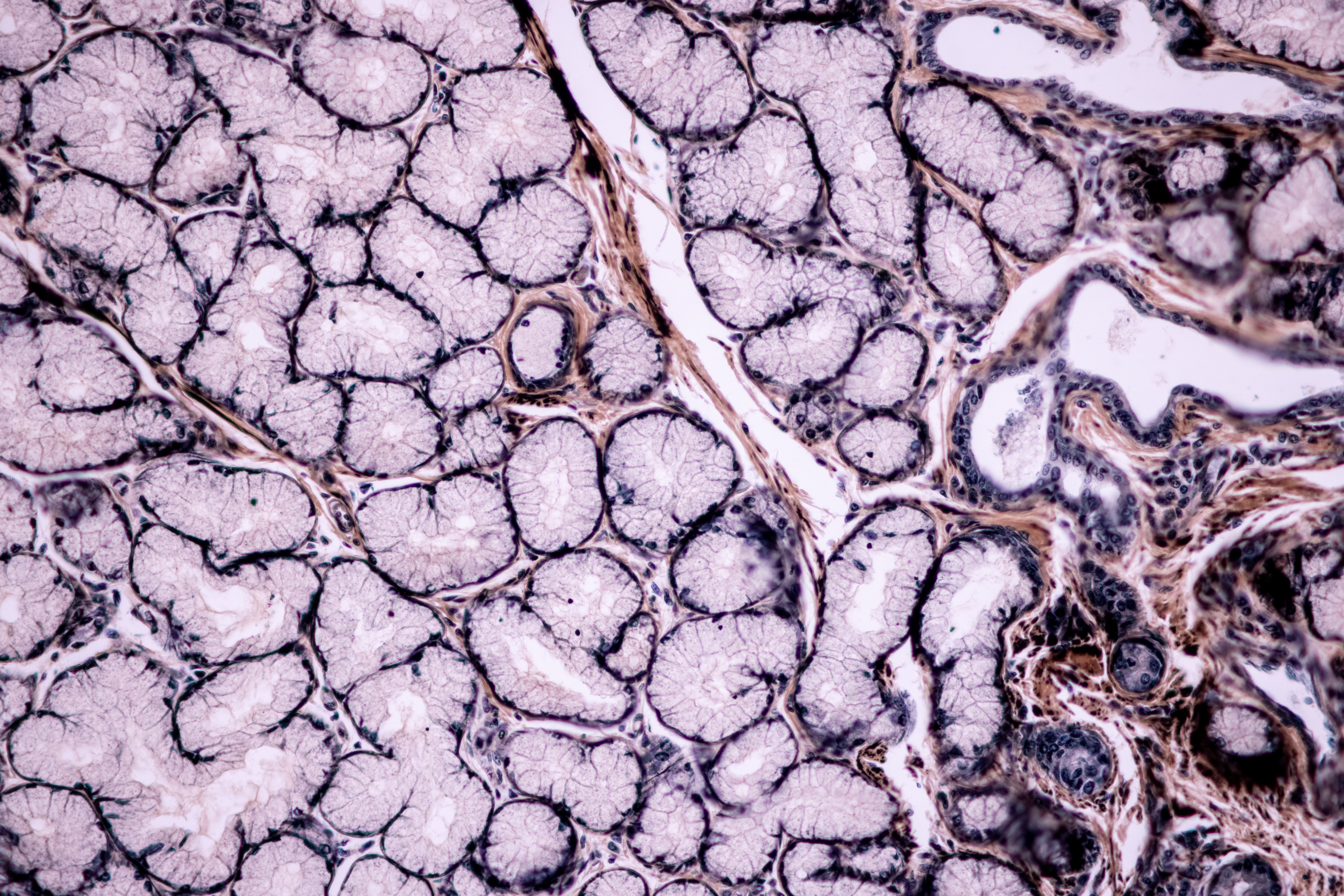 Histologische Aufnahme mit zahlreichen acinären (beerenförmigen) Endstücken