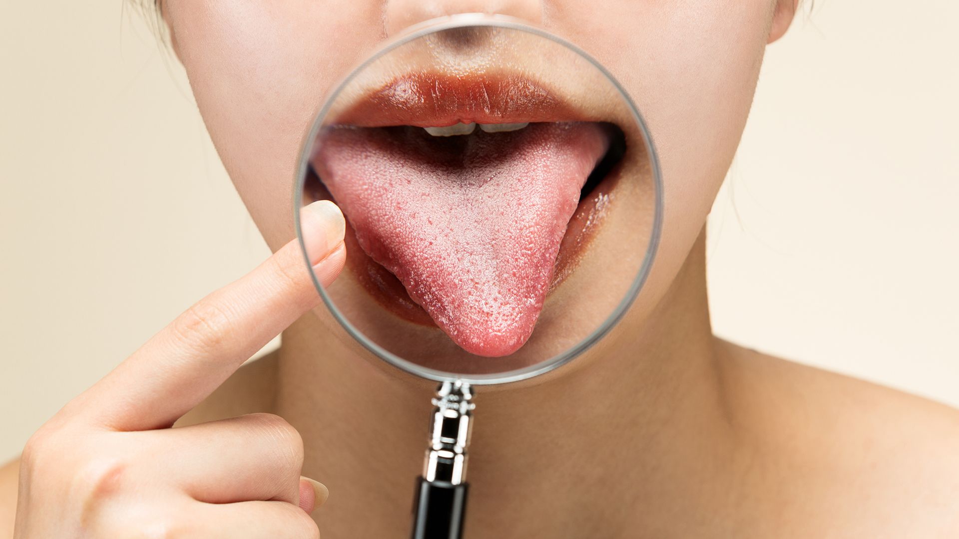 Blickdiagnostik Zunge