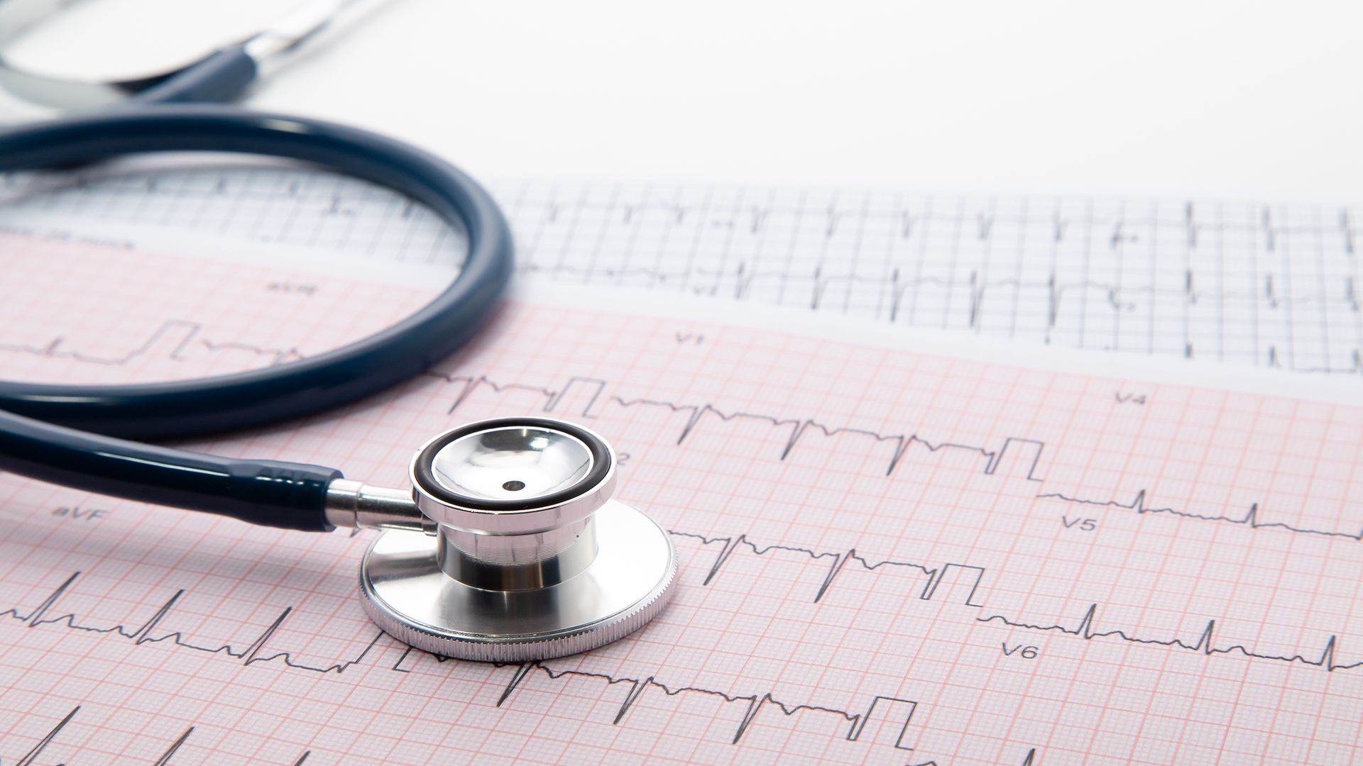 EKG Kurve
