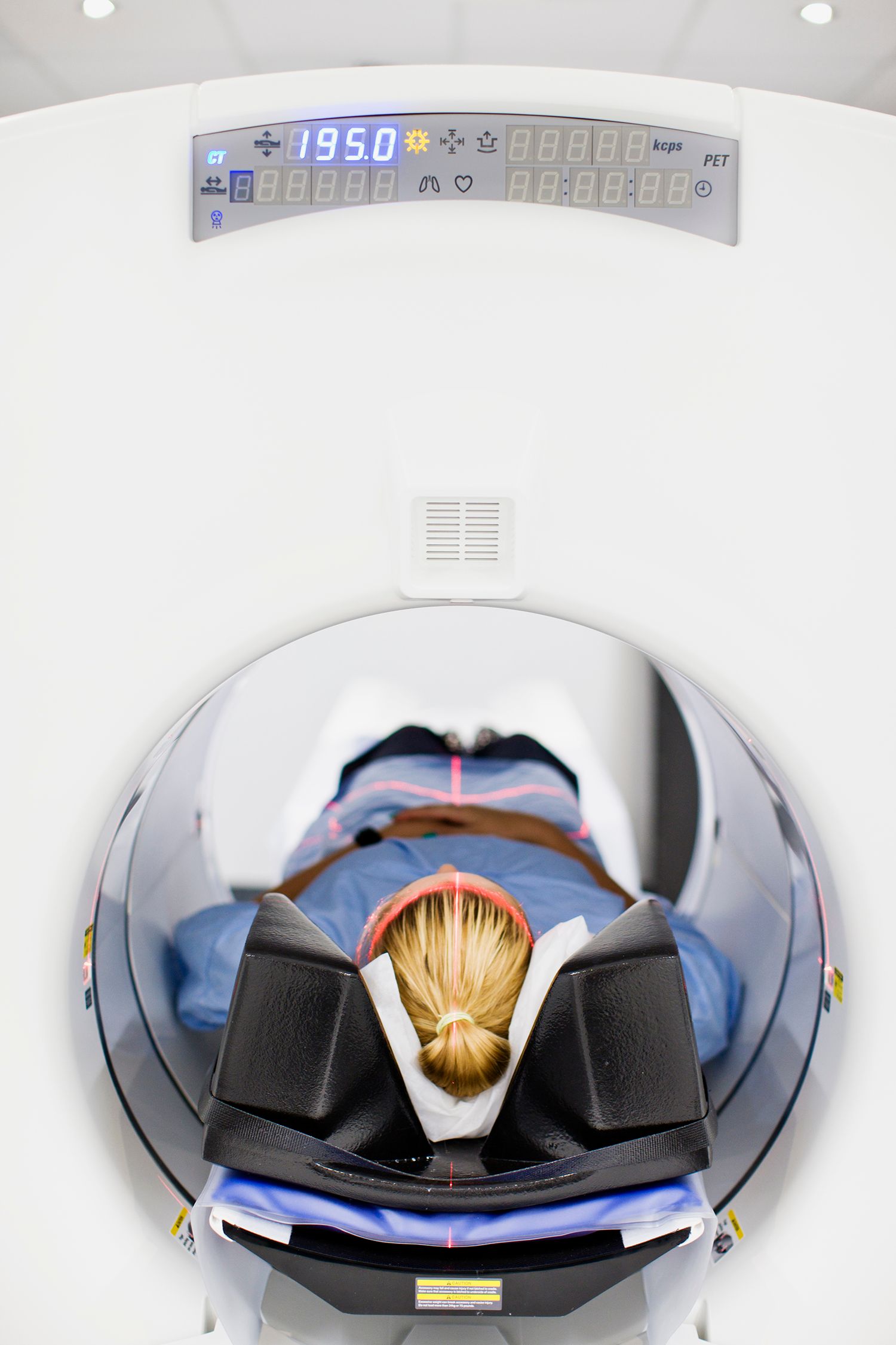 Pet Scan​​​​‌﻿‍﻿​‍​‍‌‍﻿﻿‌﻿​‍‌‍‍‌‌‍‌﻿‌‍‍‌‌‍﻿‍​‍​‍​﻿‍‍​‍​‍‌﻿​﻿‌‍​‌‌‍﻿‍‌‍‍‌‌﻿‌​‌﻿‍‌​‍﻿‍‌‍‍‌‌‍﻿﻿​‍​‍​‍﻿​​‍​‍‌‍‍​‌﻿​‍‌‍‌‌‌‍‌‍​‍​‍​﻿‍‍​‍​‍‌‍‍​‌﻿‌​‌﻿‌​‌﻿​​‌﻿​﻿​﻿‍‍​‍﻿﻿​‍﻿﻿‌‍﻿‌‌‍﻿‌​‍﻿‌‌‍​‌‌‍﻿​‌‍‌‍​‍﻿‌‌﻿​﻿‌‍‍‌‌﻿‌​‌‍‌‌​‍﻿‍‌﻿‌‍‌‍‌‌‌﻿​‍‌‍​﻿‌‍‌‌‌‍﻿​​‍﻿‍‌‍​‌‌﻿​​‌﻿​​​‍﻿﻿‌﻿​﻿‌﻿‌​‌﻿‌‌‌‍‌​‌‍‍‌‌‍﻿﻿​‍﻿﻿‌‍‍‌‌‍﻿‍‌﻿‌​‌‍‌‌‌‍﻿‍‌﻿‌​​‍﻿﻿‌‍‌‌‌‍‌​‌‍‍‌‌﻿‌​​‍﻿﻿‌‍﻿‌‌‍﻿﻿‌‍‌​‌‍‌‌​﻿﻿‌‌﻿​​‌﻿​‍‌‍‌‌‌﻿​﻿‌‍‌‌‌‍﻿‍‌﻿‌​‌‍​‌‌﻿‌​‌‍‍‌‌‍﻿﻿‌‍﻿‍​﻿‍﻿‌‍‍‌‌‍‌​​﻿﻿‌​﻿‌﻿​﻿‍‌​﻿‌​‌‍‌‍​﻿​​‌‍​﻿​﻿‌‌‌‍‌‌​‍﻿‌​﻿​‌​﻿‌﻿​﻿​​​﻿‌‍​‍﻿‌​﻿‌​​﻿‌‍​﻿​﻿‌‍​﻿​‍﻿‌​﻿‍​​﻿‌​​﻿‌﻿​﻿​﻿​‍﻿‌‌‍​‍​﻿‌‌​﻿​​‌‍‌‌​﻿‌​​﻿‍​​﻿​‌​﻿‌﻿‌‍​‍​﻿‍‌​﻿‍‌‌‍​‌​﻿‍﻿‌﻿‌​‌﻿‍‌‌﻿​​‌‍‌‌​﻿﻿‌‌‍‍‌‌‍﻿‍‌﻿‌‍‌‍‌‌‌﻿​﻿‌﻿‌​‌‍﻿‌‌‍‌‌‌‍﻿‍‌﻿‌​​‍﻿‌‌﻿​​‌‍﻿﻿‌﻿​﻿‌﻿‌​​﻿‍﻿‌﻿​​‌‍​‌‌﻿‌​‌‍‍​​﻿﻿‌‌‍‍‌‌‍﻿‌‌‍​‌‌‍‌﻿‌‍‌‌‌﻿​﻿​‍‌‌​﻿‌‌‌​​‍‌‌﻿﻿‌‍‍﻿‌‍‌‌‌﻿‍‌​‍‌‌​﻿​﻿‌​‌​​‍‌‌​﻿​﻿‌​‌​​‍‌‌​﻿​‍​﻿​‍‌‍‌‍‌‍​‍‌‍​﻿​﻿​​‌‍​‌‌‍​﻿​﻿‌﻿‌‍‌​​﻿‌‍‌‍​‌‌‍‌‌‌‍‌​​‍‌‌​﻿​‍​﻿​‍​‍‌‌​﻿‌‌‌​‌​​‍﻿‍‌‍​‌‌‍﻿​‌﻿‌​​﻿﻿﻿‌‍​‍‌‍​‌‌﻿​﻿‌‍‌‌‌‌‌‌‌﻿​‍‌‍﻿​​﻿﻿‌‌‍‍​‌﻿‌​‌﻿‌​‌﻿​​‌﻿​﻿​‍‌‌​﻿​﻿‌​​‌​‍‌‌​﻿​‍‌​‌‍​‍‌‌​﻿​‍‌​‌‍‌‍﻿‌‌‍﻿‌​‍﻿‌‌‍​‌‌‍﻿​‌‍‌‍​‍﻿‌‌﻿​﻿‌‍‍‌‌﻿‌​‌‍‌‌​‍﻿‍‌﻿‌‍‌‍‌‌‌﻿​‍‌‍​﻿‌‍‌‌‌‍﻿​​‍﻿‍‌‍​‌‌﻿​​‌﻿​​​‍‌‌​﻿​‍‌​‌‍‌﻿​﻿‌﻿‌​‌﻿‌‌‌‍‌​‌‍‍‌‌‍﻿﻿​‍‌‍‌‍‍‌‌‍‌​​﻿﻿‌​﻿‌﻿​﻿‍‌​﻿‌​‌‍‌‍​﻿​​‌‍​﻿​﻿‌‌‌‍‌‌​‍﻿‌​﻿​‌​﻿‌﻿​﻿​​​﻿‌‍​‍﻿‌​﻿‌​​﻿‌‍​﻿​﻿‌‍​﻿​‍﻿‌​﻿‍​​﻿‌​​﻿‌﻿​﻿​﻿​‍﻿‌‌‍​‍​﻿‌‌​﻿​​‌‍‌‌​﻿‌​​﻿‍​​﻿​‌​﻿‌﻿‌‍​‍​﻿‍‌​﻿‍‌‌‍​‌​‍‌‍‌﻿‌​‌﻿‍‌‌﻿​​‌‍‌‌​﻿﻿‌‌‍‍‌‌‍﻿‍‌﻿‌‍‌‍‌‌‌﻿​﻿‌﻿‌​‌‍﻿‌‌‍‌‌‌‍﻿‍‌﻿‌​​‍﻿‌‌﻿​​‌‍﻿﻿‌﻿​﻿‌﻿‌​​‍‌‍‌﻿​​‌‍​‌‌﻿‌​‌‍‍​​﻿﻿‌‌‍‍‌‌‍﻿‌‌‍​‌‌‍‌﻿‌‍‌‌‌﻿​﻿​‍‌‌​﻿‌‌‌​​‍‌‌﻿﻿‌‍‍﻿‌‍‌‌‌﻿‍‌​‍‌‌​﻿​﻿‌​‌​​‍‌‌​﻿​﻿‌​‌​​‍‌‌​﻿​‍​﻿​‍‌‍‌‍‌‍​‍‌‍​﻿​﻿​​‌‍​‌‌‍​﻿​﻿‌﻿‌‍‌​​﻿‌‍‌‍​‌‌‍‌‌‌‍‌​​‍‌‌​﻿​‍​﻿​‍​‍‌‌​﻿‌‌‌​‌​​‍﻿‍‌‍​‌‌‍﻿​‌﻿‌​​‍‌‍‌﻿​​‌‍‌‌‌﻿​‍‌﻿​﻿‌﻿​​‌‍‌‌‌‍​﻿‌﻿‌​‌‍‍‌‌﻿‌‍‌‍‌‌​﻿﻿‌‌﻿​​‌﻿‌‌‌‍​‍‌‍﻿​‌‍‍‌‌﻿​﻿‌‍‍​‌‍‌‌‌‍‌​​‍​‍‌﻿﻿‌