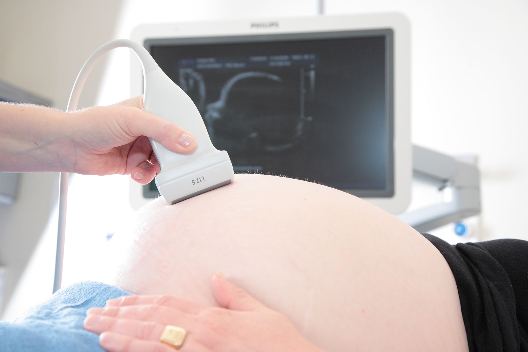 Ultrasound​​​​‌﻿‍﻿​‍​‍‌‍﻿﻿‌﻿​‍‌‍‍‌‌‍‌﻿‌‍‍‌‌‍﻿‍​‍​‍​﻿‍‍​‍​‍‌﻿​﻿‌‍​‌‌‍﻿‍‌‍‍‌‌﻿‌​‌﻿‍‌​‍﻿‍‌‍‍‌‌‍﻿﻿​‍​‍​‍﻿​​‍​‍‌‍‍​‌﻿​‍‌‍‌‌‌‍‌‍​‍​‍​﻿‍‍​‍​‍‌‍‍​‌﻿‌​‌﻿‌​‌﻿​​‌﻿​﻿​﻿‍‍​‍﻿﻿​‍﻿﻿‌‍﻿‌‌‍﻿‌​‍﻿‌‌‍​‌‌‍﻿​‌‍‌‍​‍﻿‌‌﻿​﻿‌‍‍‌‌﻿‌​‌‍‌‌​‍﻿‍‌﻿‌‍‌‍‌‌‌﻿​‍‌‍​﻿‌‍‌‌‌‍﻿​​‍﻿‍‌‍​‌‌﻿​​‌﻿​​​‍﻿﻿‌﻿​﻿‌﻿‌​‌﻿‌‌‌‍‌​‌‍‍‌‌‍﻿﻿​‍﻿﻿‌‍‍‌‌‍﻿‍‌﻿‌​‌‍‌‌‌‍﻿‍‌﻿‌​​‍﻿﻿‌‍‌‌‌‍‌​‌‍‍‌‌﻿‌​​‍﻿﻿‌‍﻿‌‌‍﻿﻿‌‍‌​‌‍‌‌​﻿﻿‌‌﻿​​‌﻿​‍‌‍‌‌‌﻿​﻿‌‍‌‌‌‍﻿‍‌﻿‌​‌‍​‌‌﻿‌​‌‍‍‌‌‍﻿﻿‌‍﻿‍​﻿‍﻿‌‍‍‌‌‍‌​​﻿﻿‌​﻿‌﻿​﻿‍‌​﻿‌​‌‍‌‍​﻿​​‌‍​﻿​﻿‌‌‌‍‌‌​‍﻿‌​﻿​‌​﻿‌﻿​﻿​​​﻿‌‍​‍﻿‌​﻿‌​​﻿‌‍​﻿​﻿‌‍​﻿​‍﻿‌​﻿‍​​﻿‌​​﻿‌﻿​﻿​﻿​‍﻿‌‌‍​‍​﻿‌‌​﻿​​‌‍‌‌​﻿‌​​﻿‍​​﻿​‌​﻿‌﻿‌‍​‍​﻿‍‌​﻿‍‌‌‍​‌​﻿‍﻿‌﻿‌​‌﻿‍‌‌﻿​​‌‍‌‌​﻿﻿‌‌‍‍‌‌‍﻿‍‌﻿‌‍‌‍‌‌‌﻿​﻿‌﻿‌​‌‍﻿‌‌‍‌‌‌‍﻿‍‌﻿‌​​‍﻿‌‌﻿​​‌‍﻿﻿‌﻿​﻿‌﻿‌​​﻿‍﻿‌﻿​​‌‍​‌‌﻿‌​‌‍‍​​﻿﻿‌‌‍‍‌‌‍﻿‌‌‍​‌‌‍‌﻿‌‍‌‌‌﻿​﻿​‍‌‌​﻿‌‌‌​​‍‌‌﻿﻿‌‍‍﻿‌‍‌‌‌﻿‍‌​‍‌‌​﻿​﻿‌​‌​​‍‌‌​﻿​﻿‌​‌​​‍‌‌​﻿​‍​﻿​‍​﻿​﻿​﻿​‍​﻿‌﻿‌‍‌‍‌‍‌‌​﻿​​‌‍​﻿‌‍​‌‌‍​‌​﻿‌​​﻿‌﻿​﻿​﻿​‍‌‌​﻿​‍​﻿​‍​‍‌‌​﻿‌‌‌​‌​​‍﻿‍‌‍​‌‌‍﻿​‌﻿‌​​﻿﻿﻿‌‍​‍‌‍​‌‌﻿​﻿‌‍‌‌‌‌‌‌‌﻿​‍‌‍﻿​​﻿﻿‌‌‍‍​‌﻿‌​‌﻿‌​‌﻿​​‌﻿​﻿​‍‌‌​﻿​﻿‌​​‌​‍‌‌​﻿​‍‌​‌‍​‍‌‌​﻿​‍‌​‌‍‌‍﻿‌‌‍﻿‌​‍﻿‌‌‍​‌‌‍﻿​‌‍‌‍​‍﻿‌‌﻿​﻿‌‍‍‌‌﻿‌​‌‍‌‌​‍﻿‍‌﻿‌‍‌‍‌‌‌﻿​‍‌‍​﻿‌‍‌‌‌‍﻿​​‍﻿‍‌‍​‌‌﻿​​‌﻿​​​‍‌‌​﻿​‍‌​‌‍‌﻿​﻿‌﻿‌​‌﻿‌‌‌‍‌​‌‍‍‌‌‍﻿﻿​‍‌‍‌‍‍‌‌‍‌​​﻿﻿‌​﻿‌﻿​﻿‍‌​﻿‌​‌‍‌‍​﻿​​‌‍​﻿​﻿‌‌‌‍‌‌​‍﻿‌​﻿​‌​﻿‌﻿​﻿​​​﻿‌‍​‍﻿‌​﻿‌​​﻿‌‍​﻿​﻿‌‍​﻿​‍﻿‌​﻿‍​​﻿‌​​﻿‌﻿​﻿​﻿​‍﻿‌‌‍​‍​﻿‌‌​﻿​​‌‍‌‌​﻿‌​​﻿‍​​﻿​‌​﻿‌﻿‌‍​‍​﻿‍‌​﻿‍‌‌‍​‌​‍‌‍‌﻿‌​‌﻿‍‌‌﻿​​‌‍‌‌​﻿﻿‌‌‍‍‌‌‍﻿‍‌﻿‌‍‌‍‌‌‌﻿​﻿‌﻿‌​‌‍﻿‌‌‍‌‌‌‍﻿‍‌﻿‌​​‍﻿‌‌﻿​​‌‍﻿﻿‌﻿​﻿‌﻿‌​​‍‌‍‌﻿​​‌‍​‌‌﻿‌​‌‍‍​​﻿﻿‌‌‍‍‌‌‍﻿‌‌‍​‌‌‍‌﻿‌‍‌‌‌﻿​﻿​‍‌‌​﻿‌‌‌​​‍‌‌﻿﻿‌‍‍﻿‌‍‌‌‌﻿‍‌​‍‌‌​﻿​﻿‌​‌​​‍‌‌​﻿​﻿‌​‌​​‍‌‌​﻿​‍​﻿​‍​﻿​﻿​﻿​‍​﻿‌﻿‌‍‌‍‌‍‌‌​﻿​​‌‍​﻿‌‍​‌‌‍​‌​﻿‌​​﻿‌﻿​﻿​﻿​‍‌‌​﻿​‍​﻿​‍​‍‌‌​﻿‌‌‌​‌​​‍﻿‍‌‍​‌‌‍﻿​‌﻿‌​​‍‌‍‌﻿​​‌‍‌‌‌﻿​‍‌﻿​﻿‌﻿​​‌‍‌‌‌‍​﻿‌﻿‌​‌‍‍‌‌﻿‌‍‌‍‌‌​﻿﻿‌‌﻿​​‌﻿‌‌‌‍​‍‌‍﻿​‌‍‍‌‌﻿​﻿‌‍‍​‌‍‌‌‌‍‌​​‍​‍‌﻿﻿‌