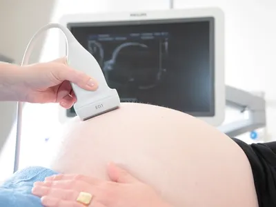 Ultrasound
