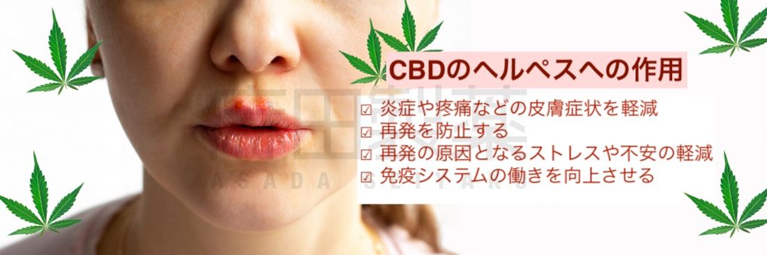 CBDのヘルペスへの作用