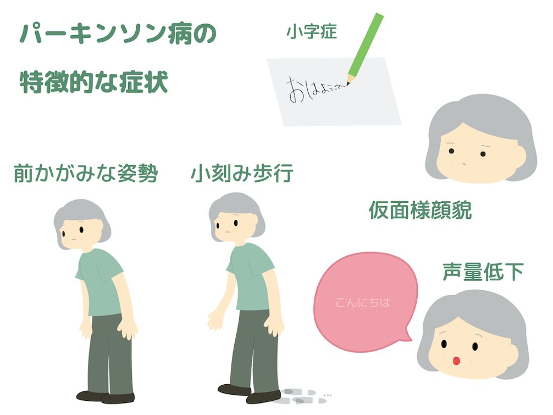 パーキンソン病