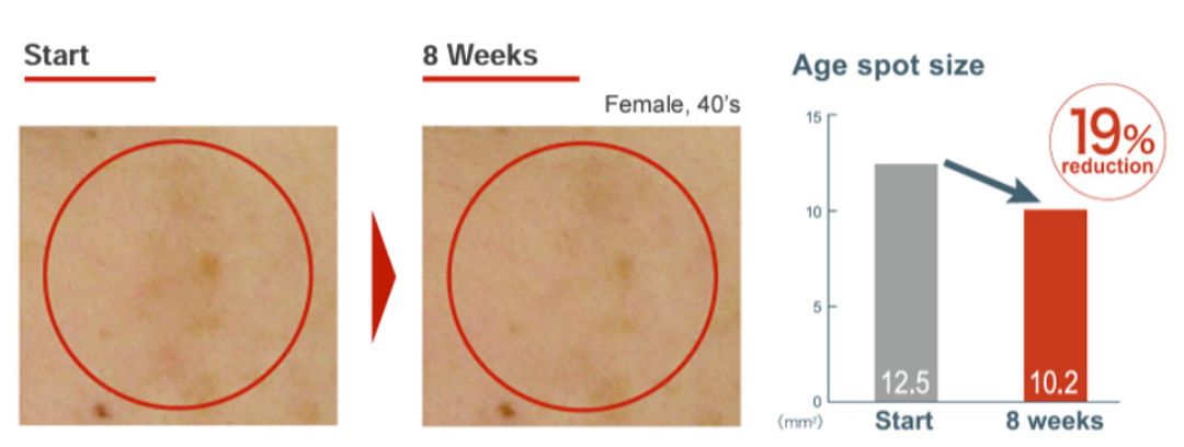 ĐỐI TÁC ASTAREAL NHẬT BẢN – NHÀ CUNG CẤP CHẤT CHỐNG OXY HÓA ASTAXANTHIN SỐ 1 THẾ GIỚI
