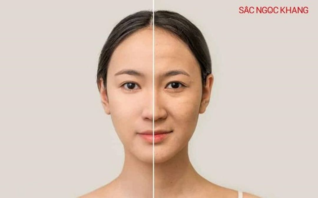 Cách chọn kem chống nắng phù hợp để bảo vệ da trong mùa hè này