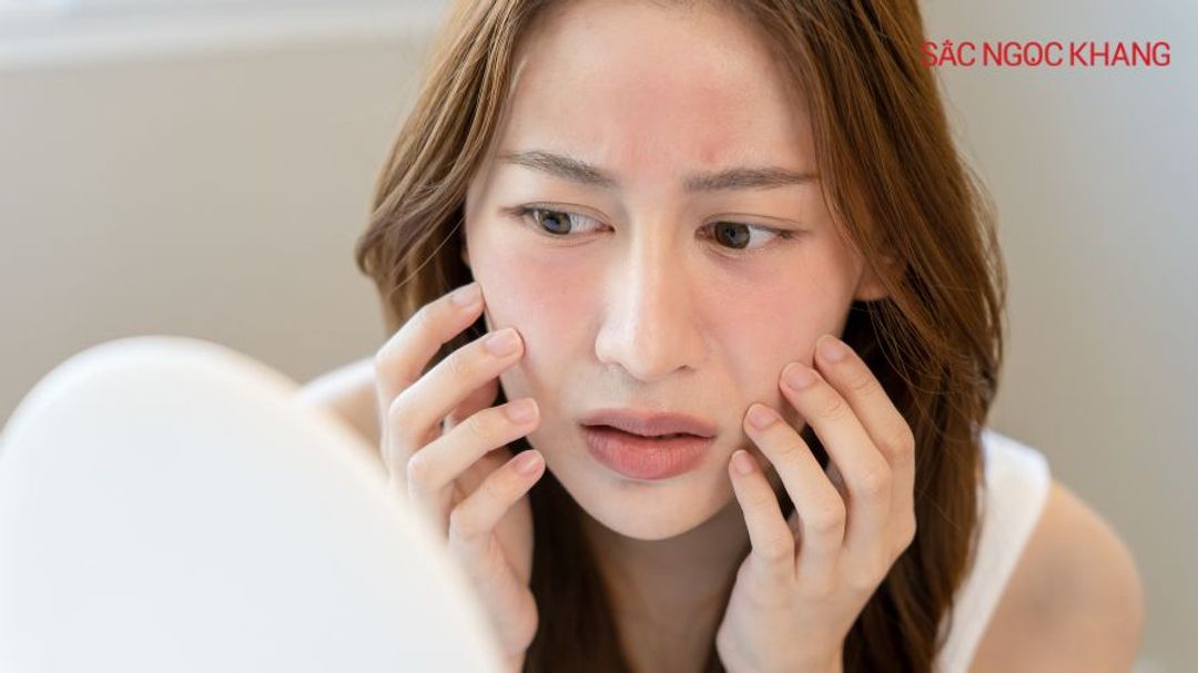 Da nhạy cảm nên chọn mặt nạ với thành phần tự nhiên, dịu nhẹ
