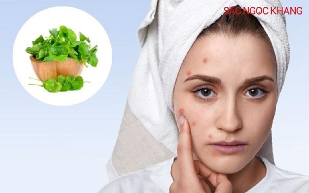 Rau má có tác dụng gì? Công dụng của rau má với sức khỏe và làn da
