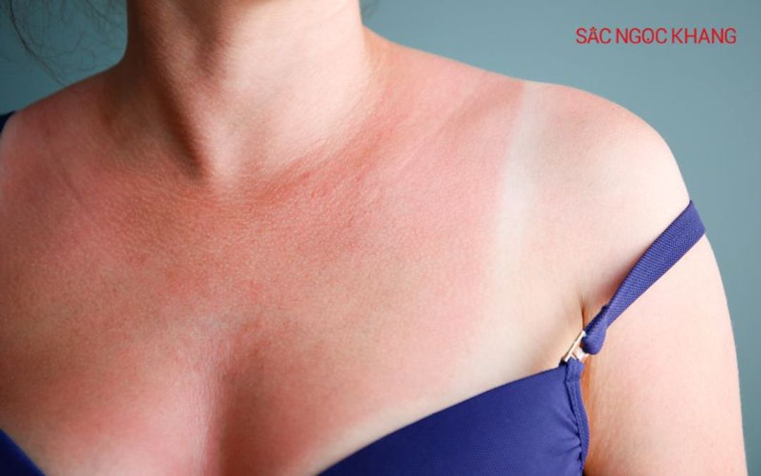 Sữa dưỡng thể có tác dụng gì? Khám phá “bí mật” giúp da khỏe đẹp