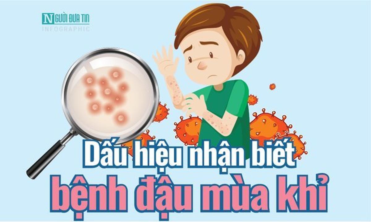 How to recognize monkeypox