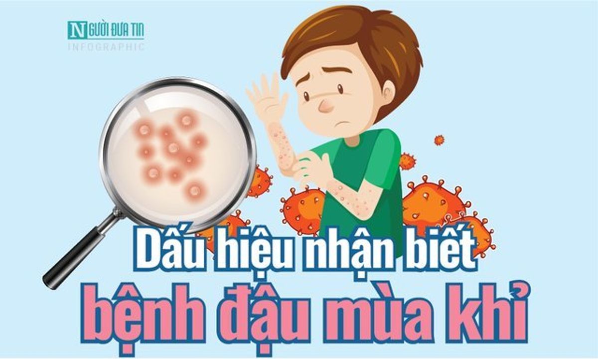 Cách nhận biết bệnh đậu mùa khỉ