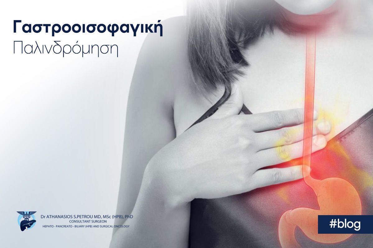 Γαστροοισοφαγική Παλινδρόμηση: Γιατί η διάγνωσή της θεωρείται πρόκληση;