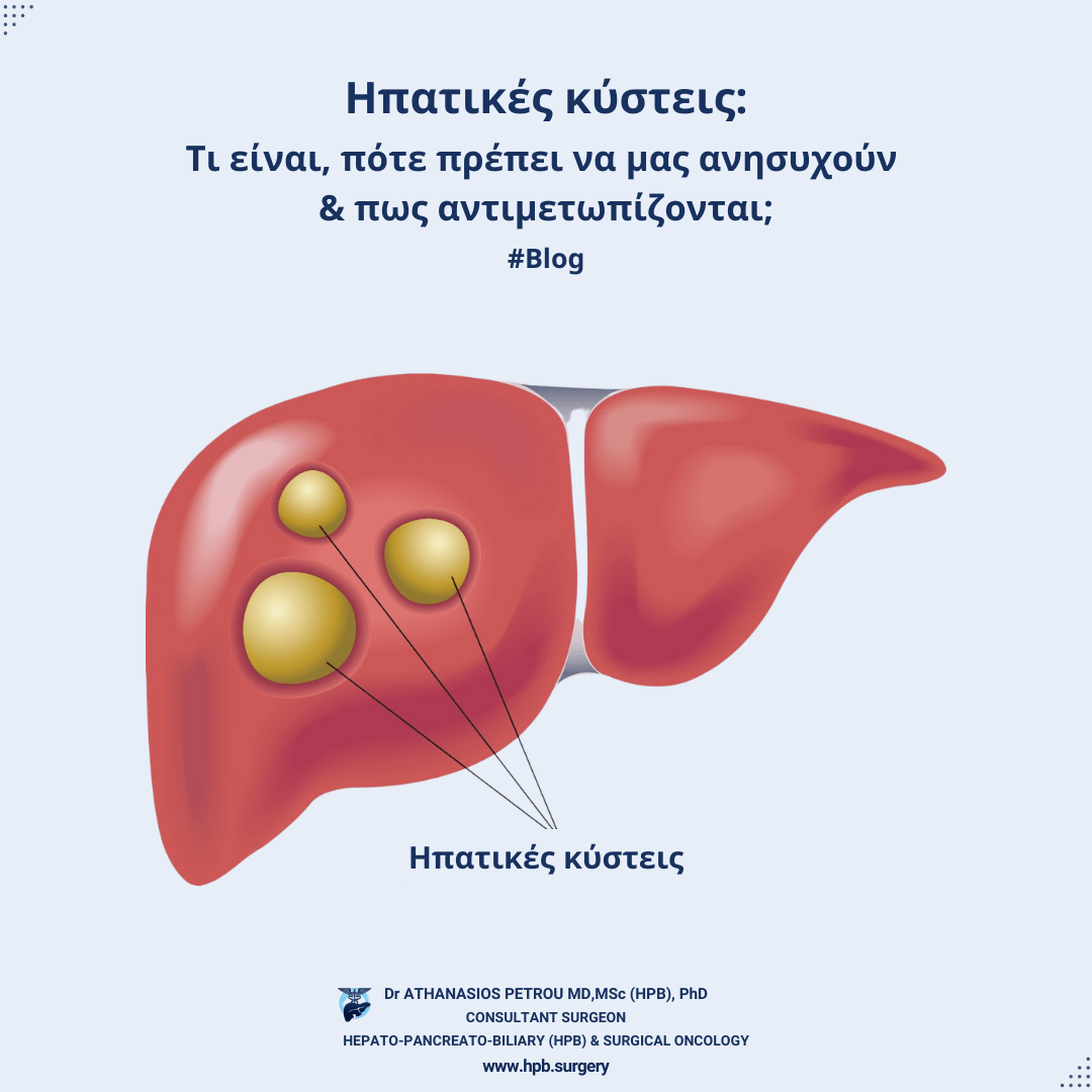 Hπατικές κύστεις: Τι είναι, πότε πρέπει να μας ανησυχούν & πως αντιμετωπίζονται;