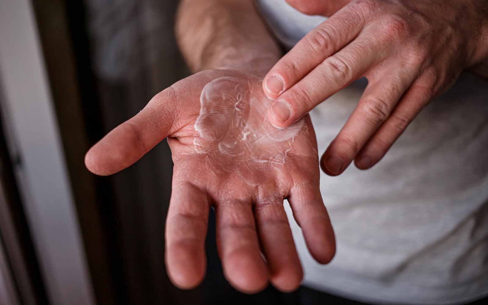 Håndpleie for tørre hender i vinter