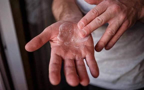 Håndpleie for tørre hender i vinter