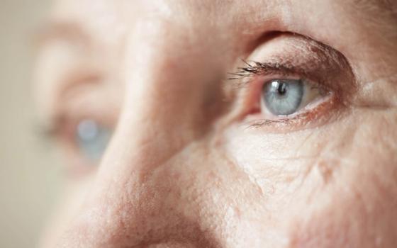 Sti på øyet Sti på øyet