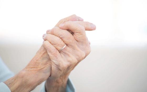 Psoriasisartritt Psoriasisartritt