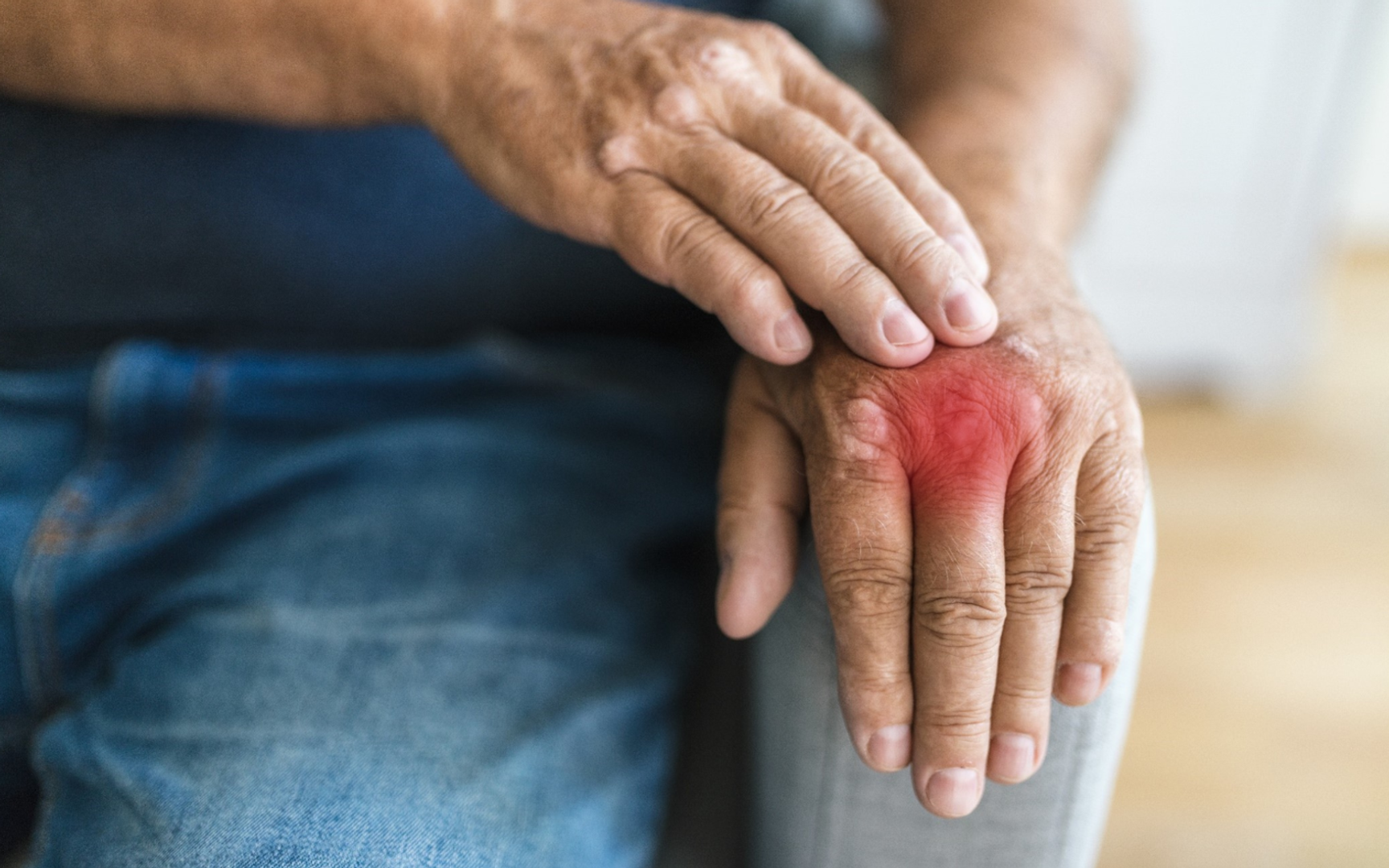 En hånd hviler mot et armlene. Et rødt område indikerer hvilket fingerledd som er smertefullt