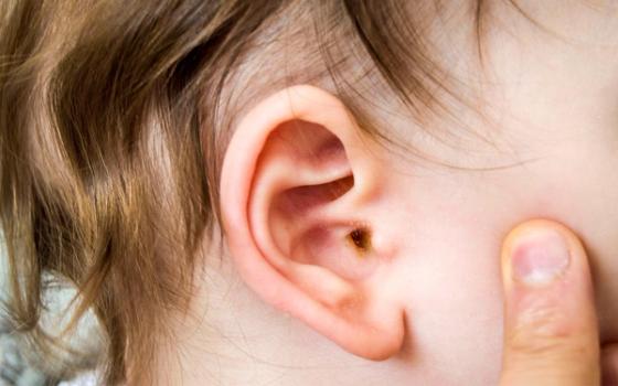 Ørebetennelse Ørebetennelse