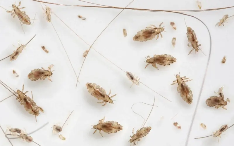 Hodelus i ulike stadier- egg, nymfer og voksne hodelus