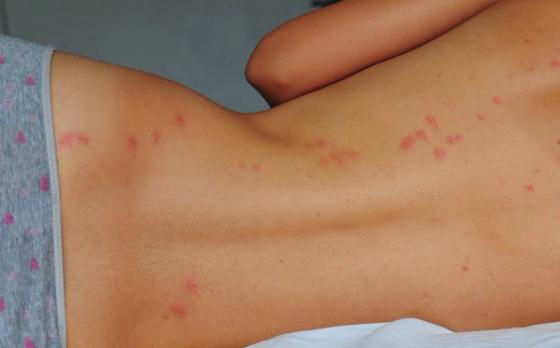 Veggedyrbitt Veggedyrbitt