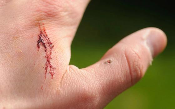 Arrbehandling Arrbehandling