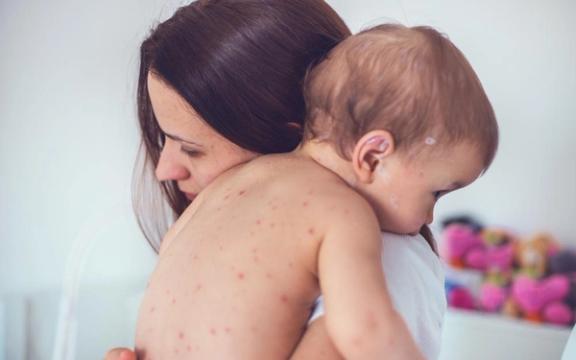 Vannkopper og smitte