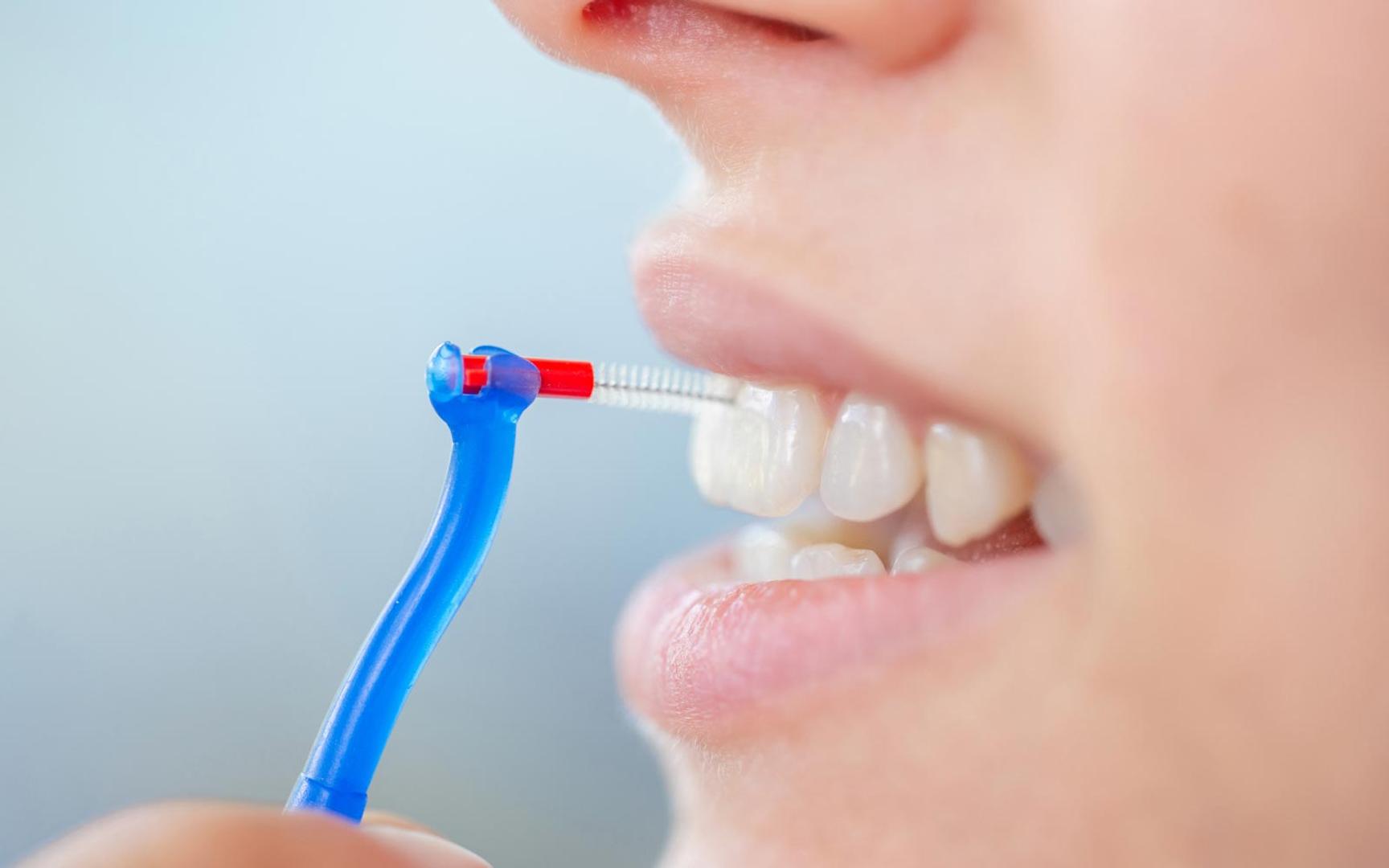 Person bruker mellomromsbørste mellom tennene.