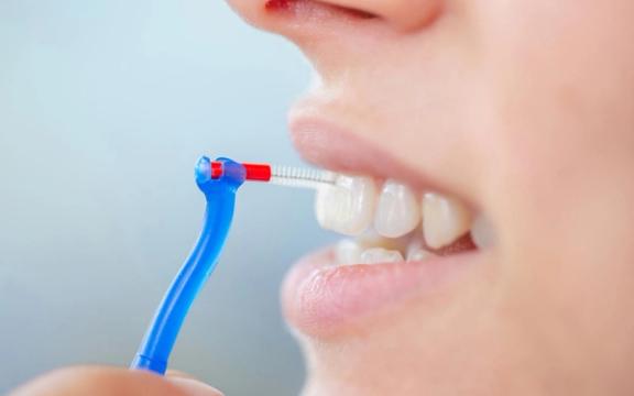 Mellomrombørste - hvorfor trenger vi det?