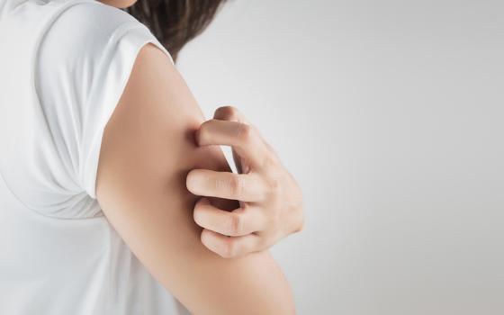 Keratosis pilaris Keratosis pilaris