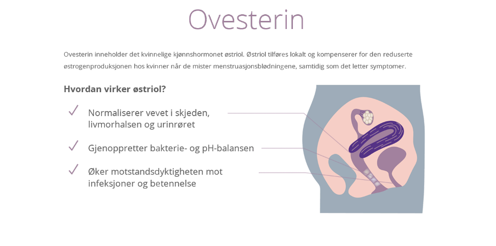 Illustrasjon av kvinnelig kjønnsorgan